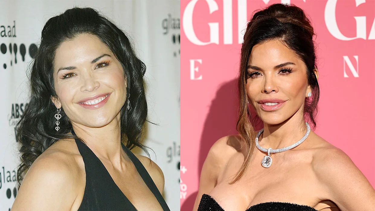 The Evolution of Lauren Sanchez: A Look at Plastic Surgery