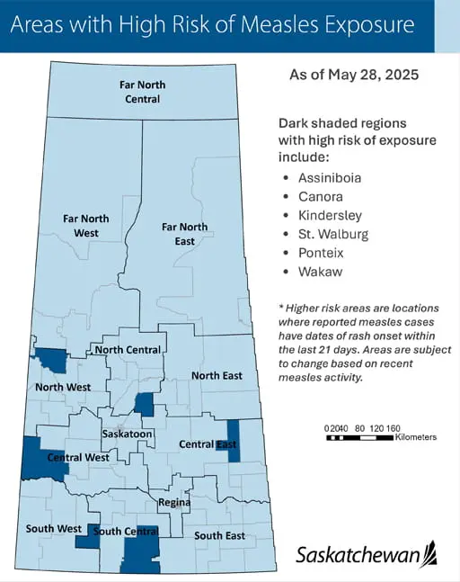 Understanding Measles Exposure Risk in Saskatoon image 1