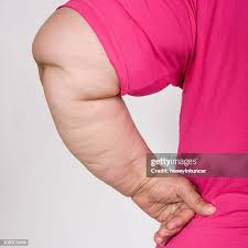 arm-stock-113.jpeg