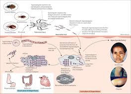 chagas-disease-64.jpeg