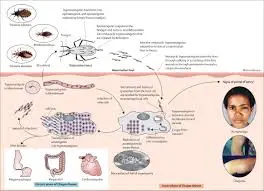 chagas-disease-64.jpeg
