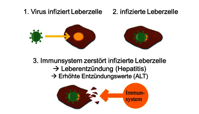 hepatitis-b-67.png