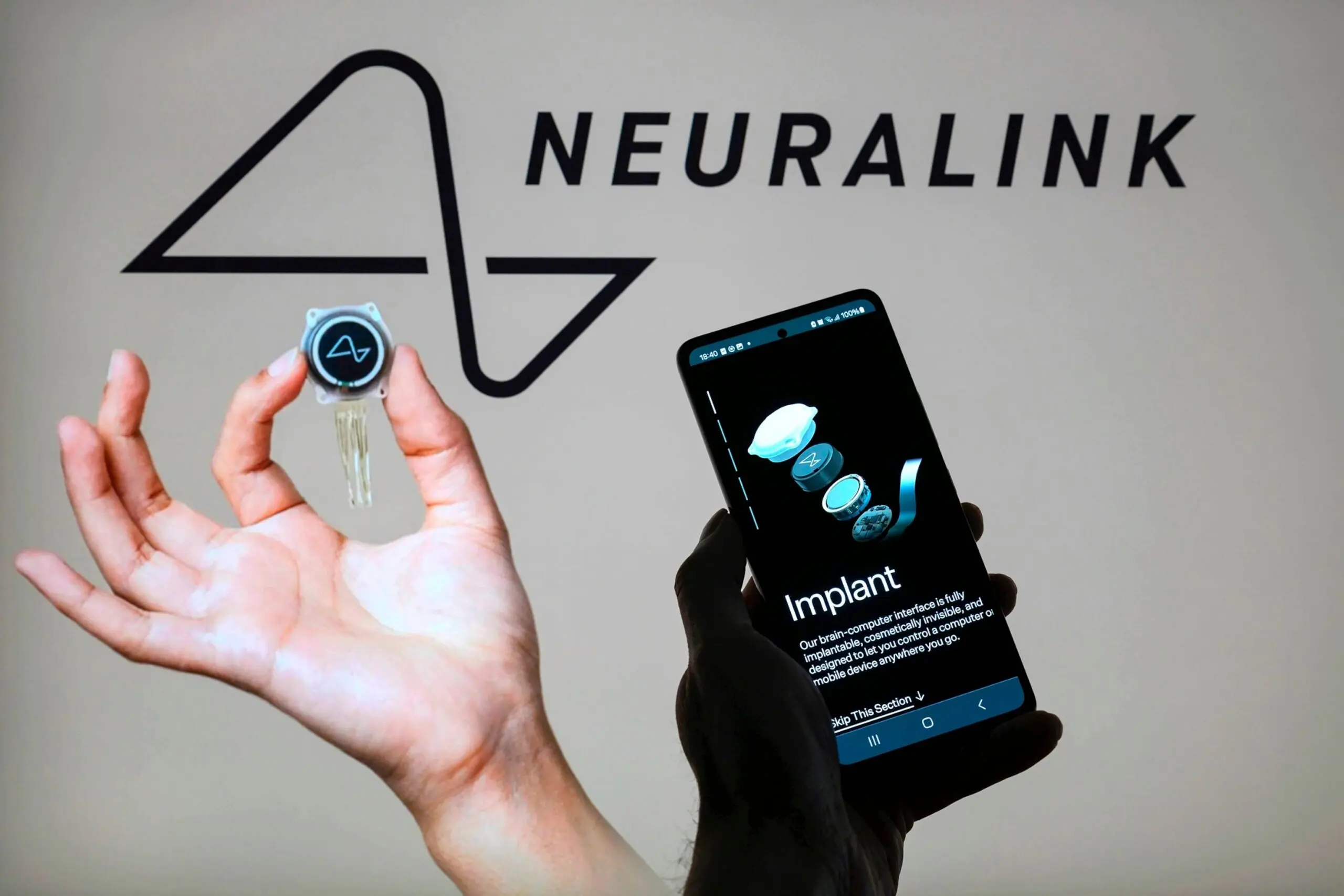Revolutionizing Neural Interfaces: The Neuralink Implant