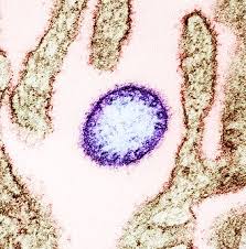 nipah-virus-273.jpeg