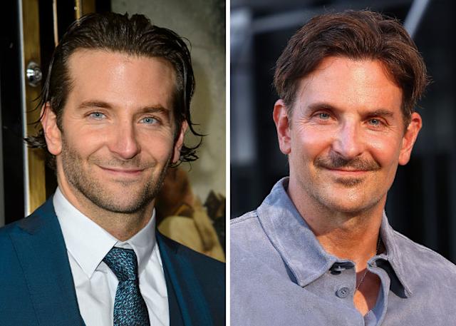 bradley-cooper-facelift-122.jpeg
