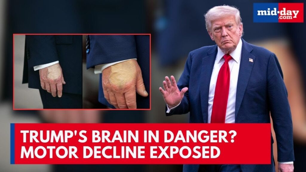 does-trump-have-dementia-190.jpeg
