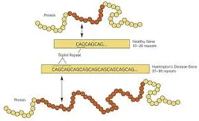 Huntington Disease: What You Need to Know