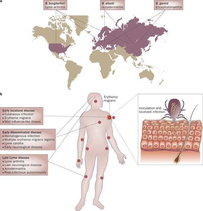 lyme-disease-209.jpeg