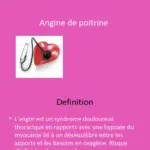 angine de poitrine tout le monde en parle — CA news