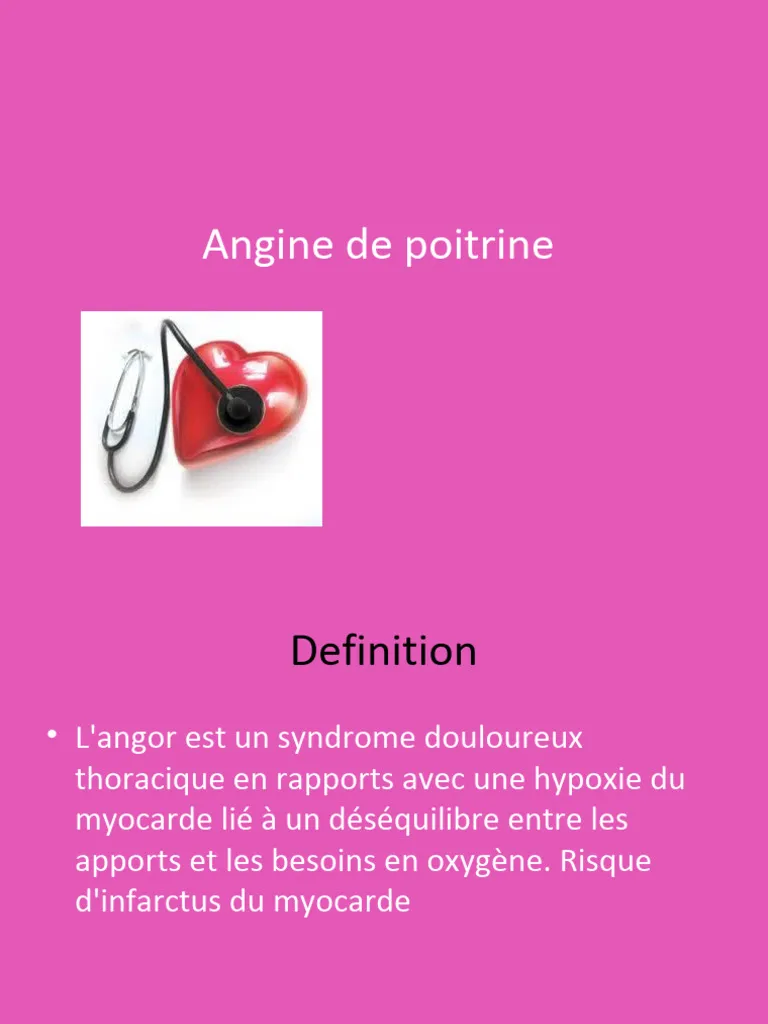 angine de poitrine — CA news